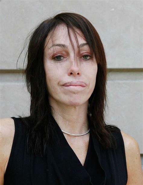 Heidi Fleiss Before And After