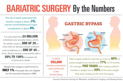 The Bariatric Surgery Options - Charleston Physicians