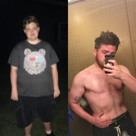 how does bottom surgery work ftm 7