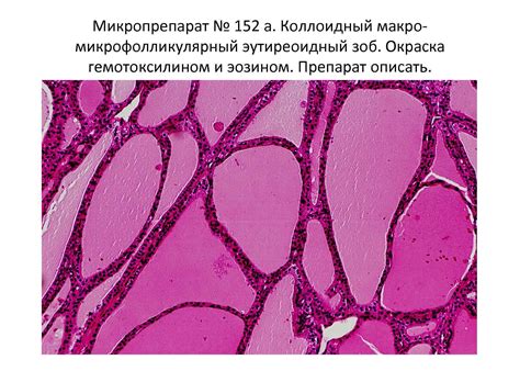 Болезни эндокринных желёз. Инсулит 2