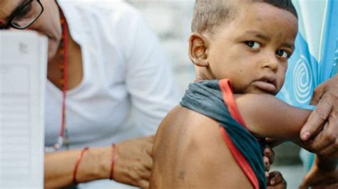 World Leprosy Day 2023: What is Leprosy? Causes, Symptoms, Treatment ...