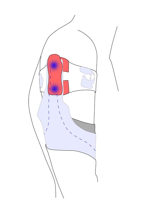 Sensitive Touch –intelligent gloves for prosthetic arms :: Behance
