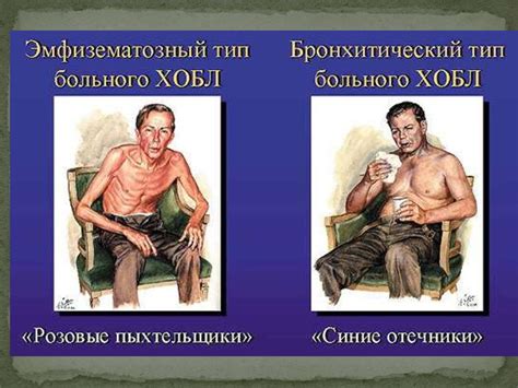 ХОБЛ Хроническая обструктивная болезнь легких - презентация онлайн