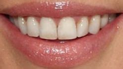 Kate Beckinsale Teeth Pictures