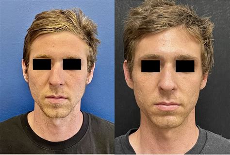 Murrieta Patch: Before & After Photos Will Astound You! Image 2