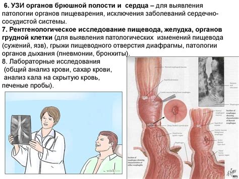 Гастроэзофагеальная рефлюксная болезнь - презентация онлайн