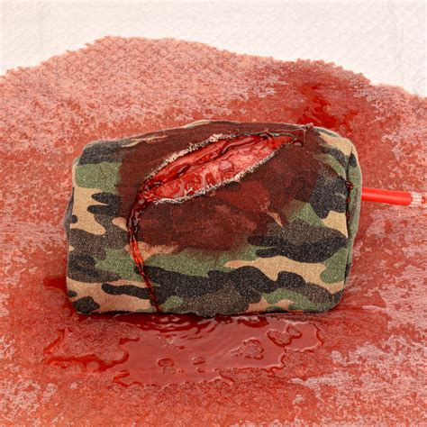 What is a Puncture Wound? Causes, Risks, and Examples – MedEduQuest