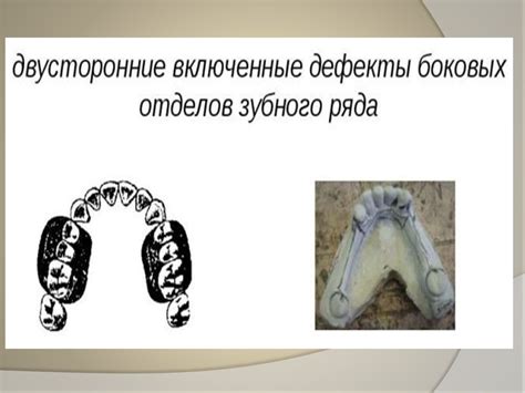Частичная потеря зубов - презентация онлайн