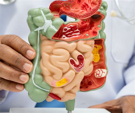 Bowel Blockage & Intestinal Obstruction Singapore | Ark Surgical