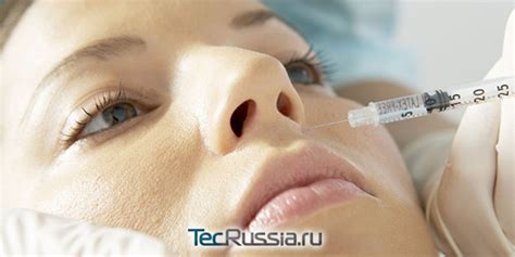 Препараты для биоревитализации – рейтинг лучших, названия, составы ...