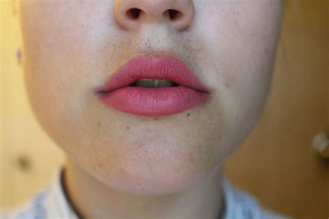 how to fix chapped lips 3