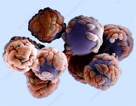 human fibroblasts stock image p science photo library