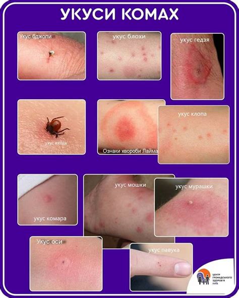 Pin by Надія Василівна on для школи | Paw print tattoo, Preventative ...