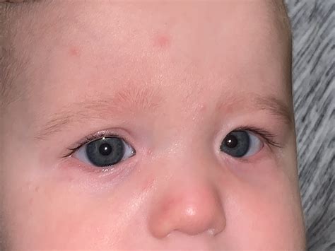 Moran CORE | Pseudoesotropia
