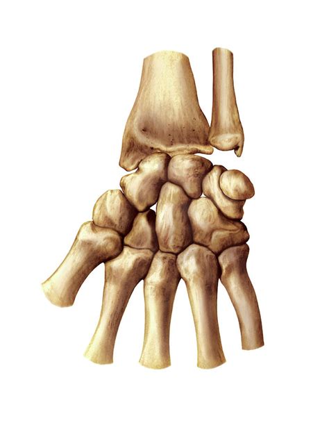 Wrist And Metacarpus Bones Photograph by Asklepios Medical Atlas - Pixels