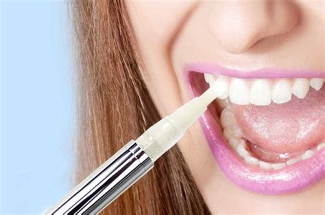 how long to leave whitening gel on teeth