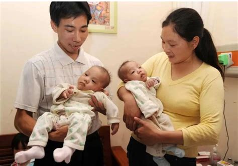 Separated conjoined twins living healthy lives - Asia News NetworkAsia ...