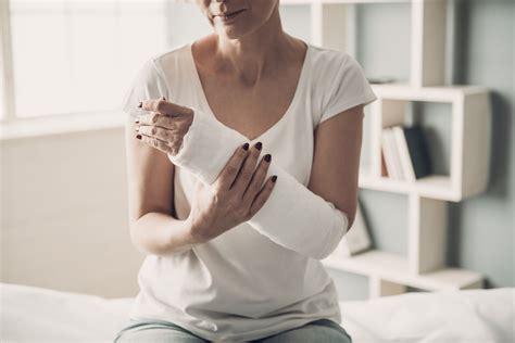 How Plaster Casts are Used to Treat Fractures