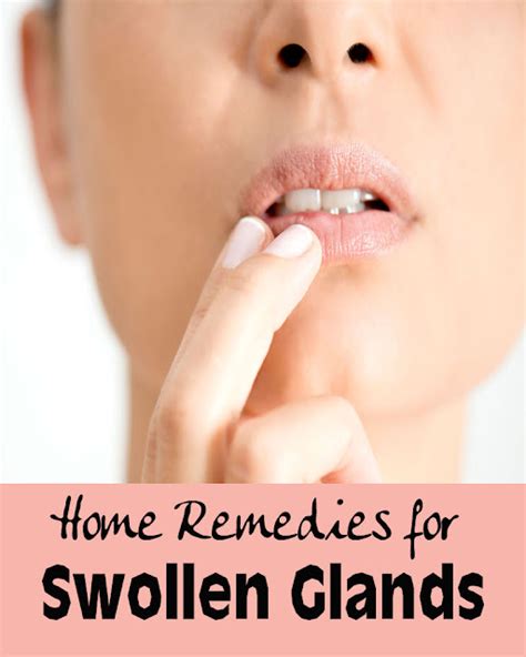 home remedies  swollen glands healthy sip