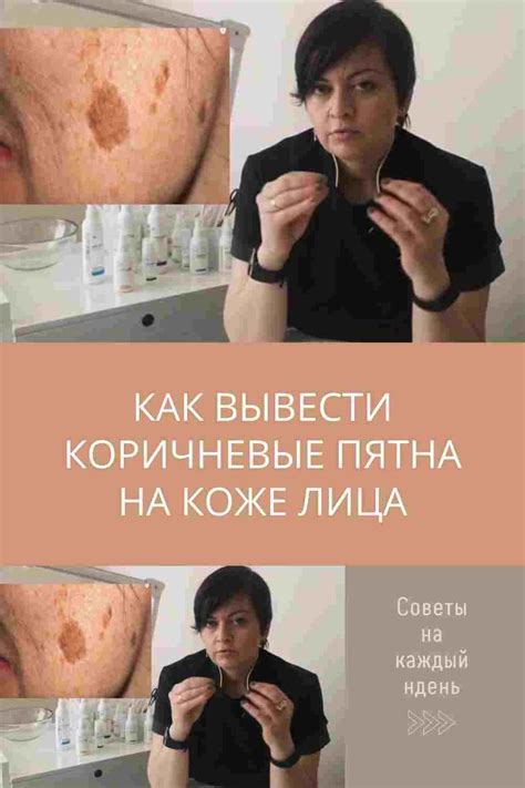 КАК ВЫВЕСТИ КОРИЧНЕВЫЕ ПЯТНА НА КОЖЕ ЛИЦА | Skin, Skin care, Beauty