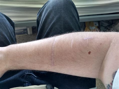 3410 best Self Harm images on Pholder | Self Harm Scars, Selfharm Memes