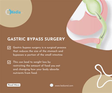 gastric bypass surgery   cons  alternative esg dallas tx