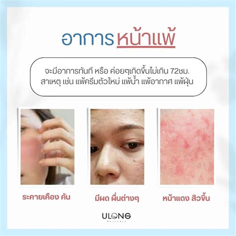 วิธีแก้หน้าติดสาร - การค้นหาใน Lemon8