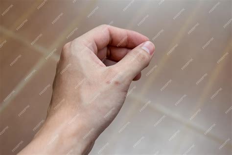 premium photo scars   hands caused  wounds  form dark