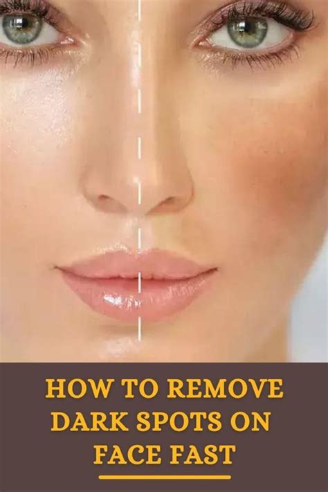 removed  dark spots    skin clearer read