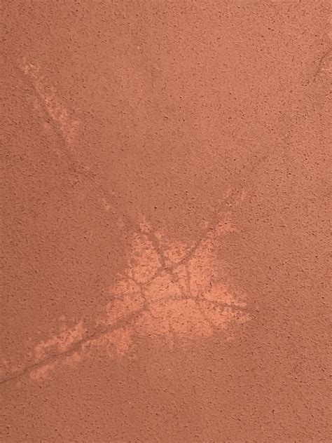 How Does Gout Affect Daily Life? - Truth About Gout