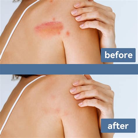 Snapklik.com : Pure Natural Organic Manuka Honey Cream Ointment, For