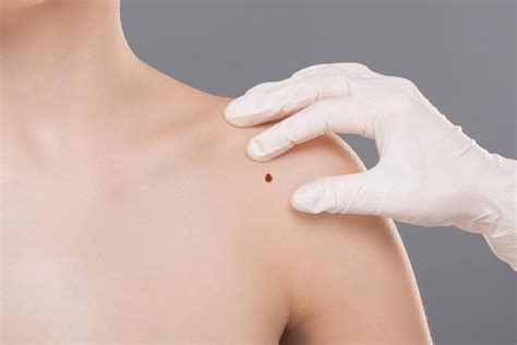 derm launches skin disease search engine american spa