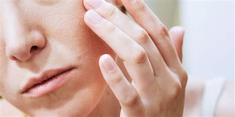 eczema in the face 4