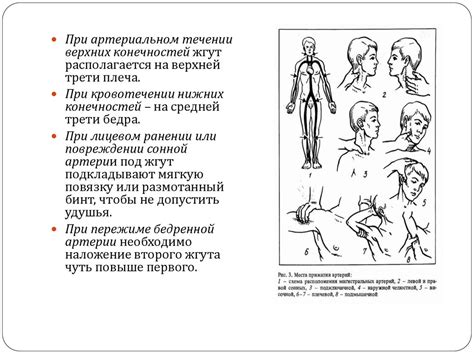 Артериальное кровотечение. Признаки и оказания первой помощи ...