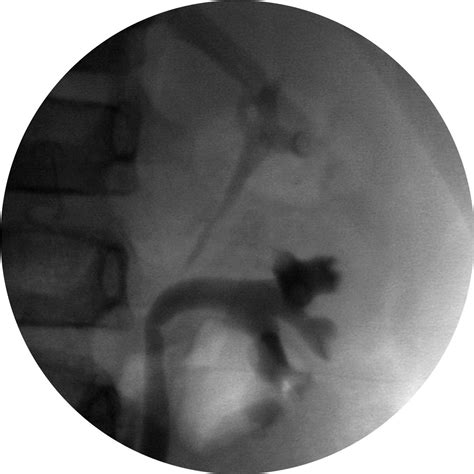 RadiologySpirit