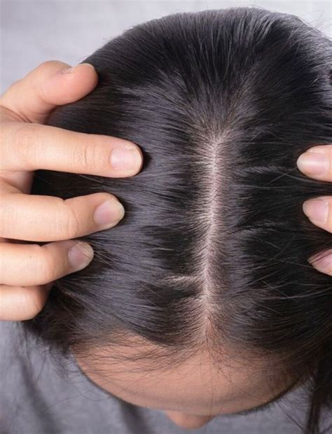 growth factor therapy