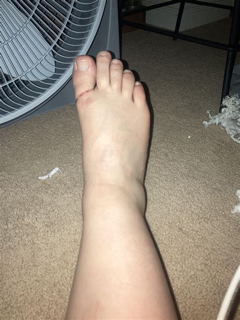 Joints and ankles : r/medical