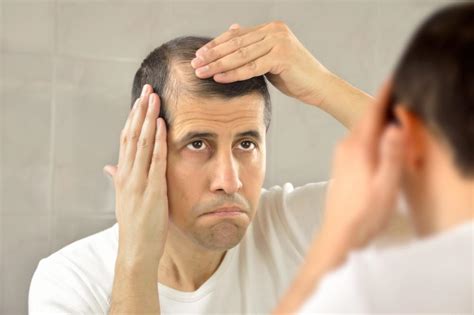 Is Your Hair Loss Due to Lupus?: Rheumatology Center of New Jersey ...