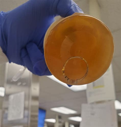 clean catch urine  er rmedlabprofessionals