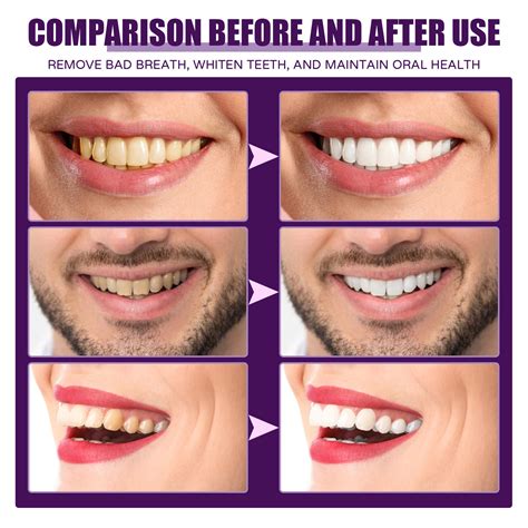 WANGJIAOID Concentrated Mouthwash To Bad Breath Yellow Teeth Stains