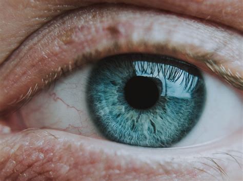 Palpebras Inchadas Pode Ser