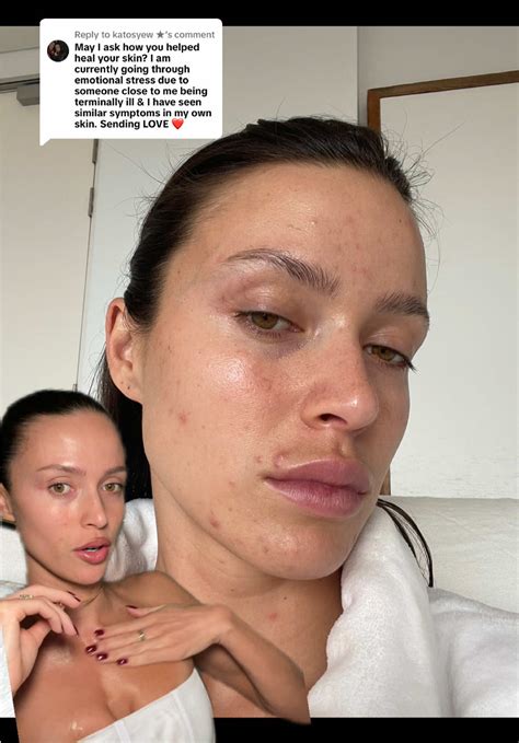 Transforming Skin: A Journey Through Grief and Healing | TikTok