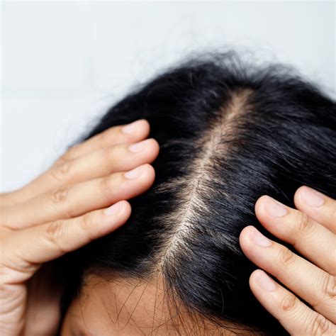 Scalp Health and How Leaf and Flower Can Optimize It – Simply Colour ... 