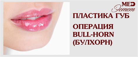 Операция Bull-horn (буллхорн) один из видов хейлопластики