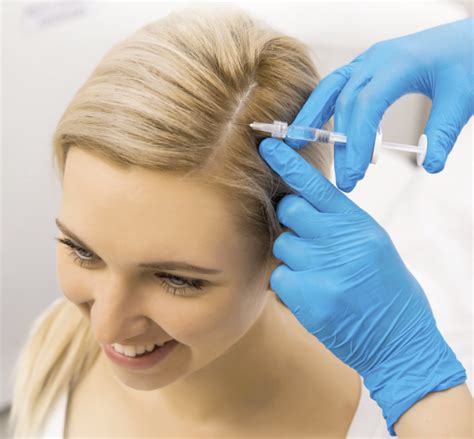 Androgenetic Alopecia Treatment with PRP