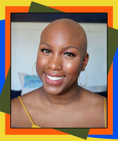 Black People Balding