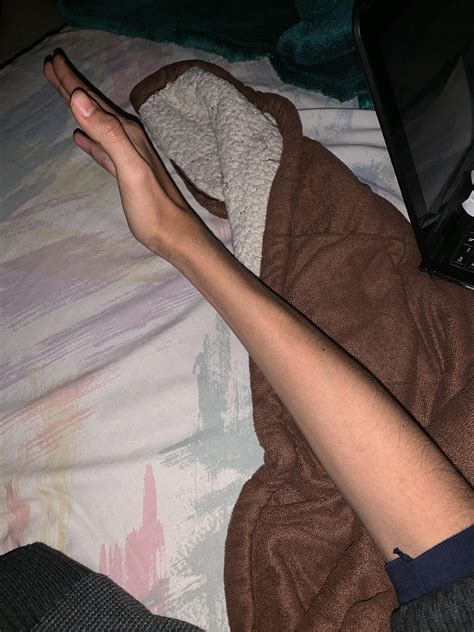 What’s wrong with me and why is my arm that skinny,I need help and