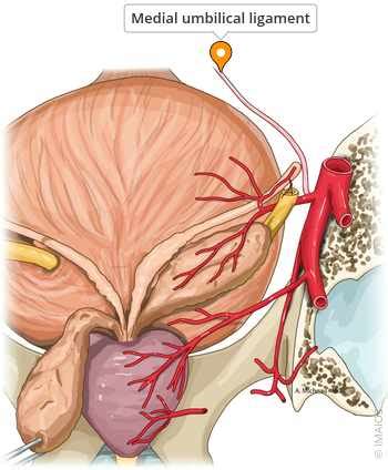 medial umbilical ligament  anatomy imaios
