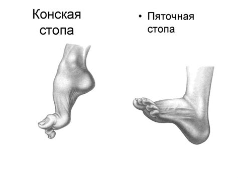 Топографическая анатомия нижней конечности - презентация онлайн