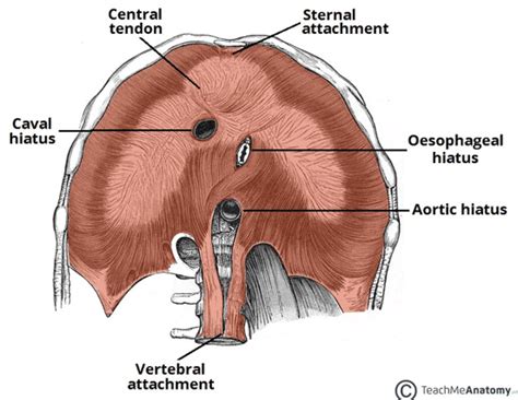 Diaphragmatic Hernia - TeachMeSurgery